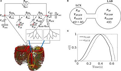 Effects of Mechanical Dyssynchrony on Coronary Flow: Insights From a Computational Model of Coupled Coronary Perfusion With Systemic Circulation